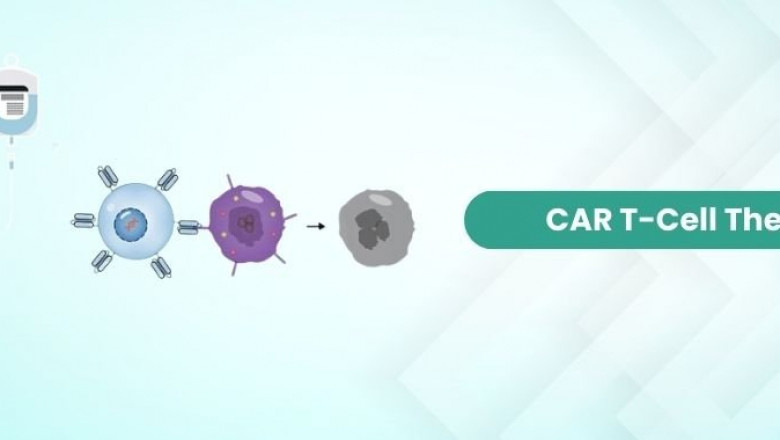 Car T Cell Therapy Cost in India – A Detailed Guide to Affordable Cancer Treatment