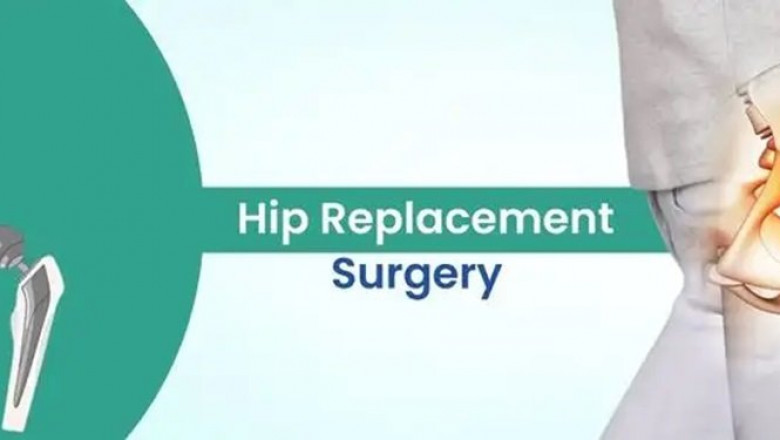 Hip Replacement Surgery Cost in India – A Complete Guide to Affordable Treatment